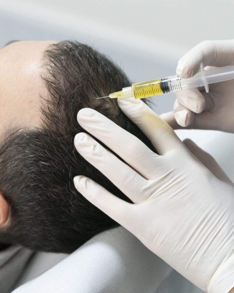 Kopfhaartransplantation - Wien