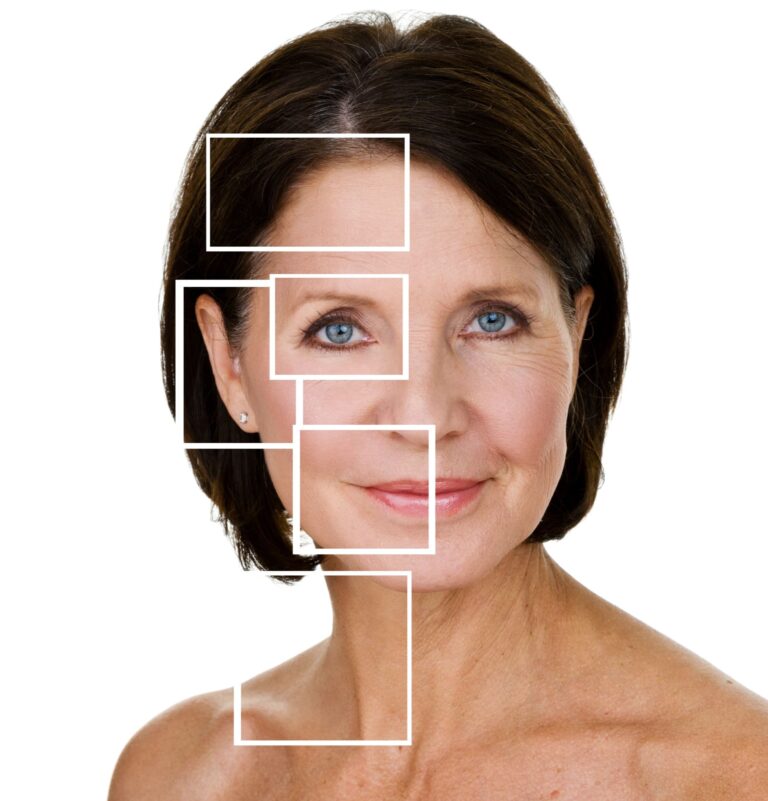 Dr. Nazmi Kabashi - Botox Unterspritzungen